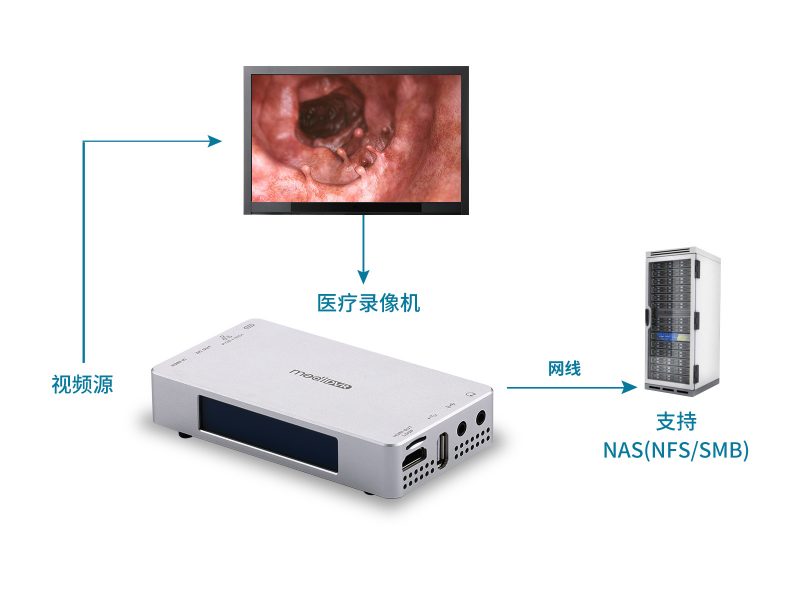 超高清4K醫(yī)療錄像機(jī)，輕便型 - 圖片 4